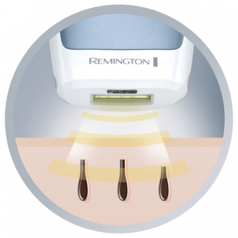 IPL3500 Hair Reduction IPL3500 Hair Reduction