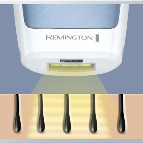 IPL3500 How It Work-1 IPL3500 How It Work-1